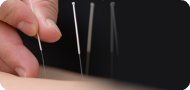 acupuncture-courses-and-acupuncture-training